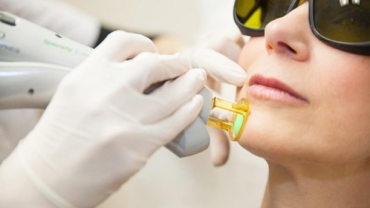 Lazer Epilasyon Hakkında Sorular Cevaplar